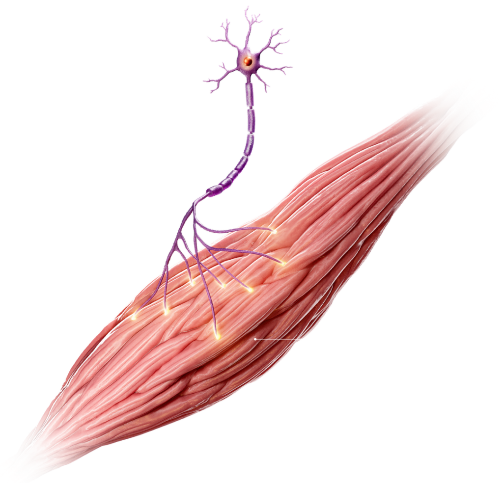 Diagram of the motor unit showing the motor neuron and muscle affected in SMA